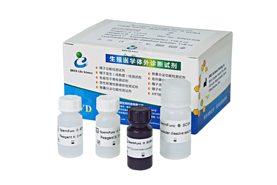 정자 DNA 분해 검사 정자 크로마틴 구조 분석 SCSA