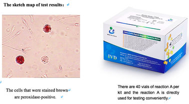 남성 생식 기관 감염 검열을 위한 정액 표본 백혈구 시험 장비 40T/Kit