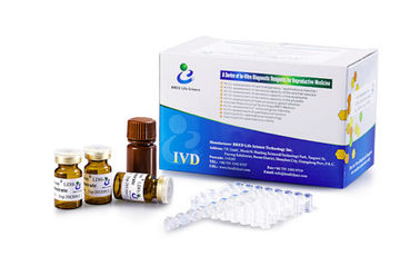 급속한 진단 결심 정액 LDH-X/LDH-C4 수준을 위한 남성 비옥 시험 장비
